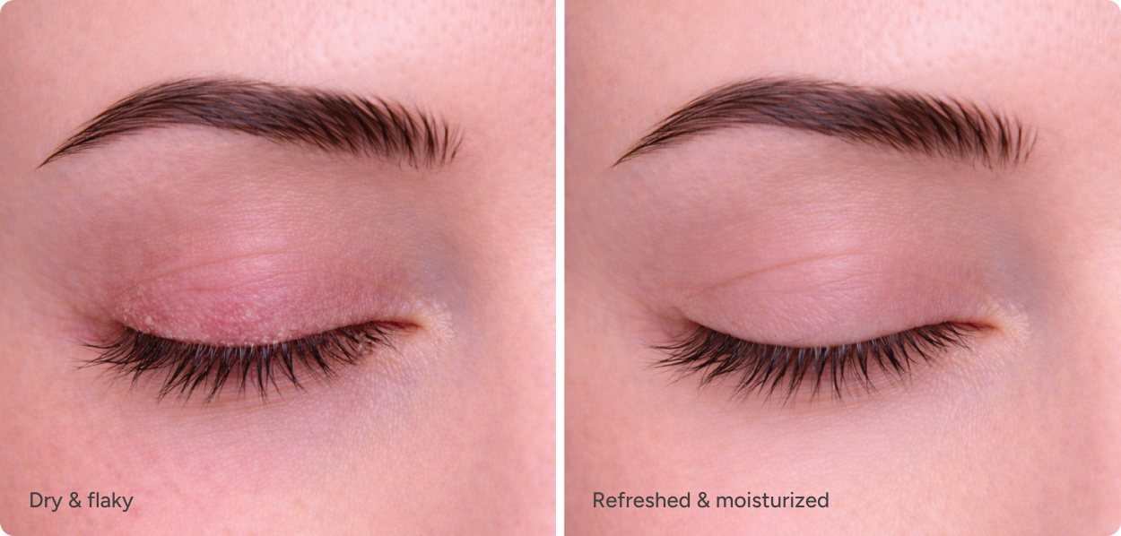 Ndemex™ Revitalizing Eye Serum with Tea Tree Oil – Bruder