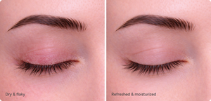 Ndemex™ Revitalizing Eye Serum with Tea Tree Oil – Bruder